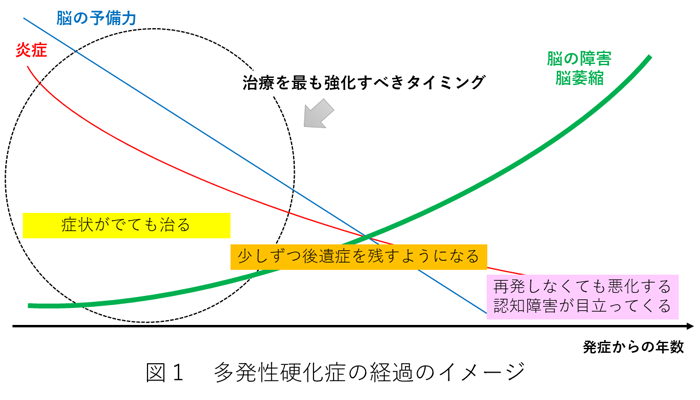 多発性硬化症