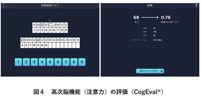 高次脳機能